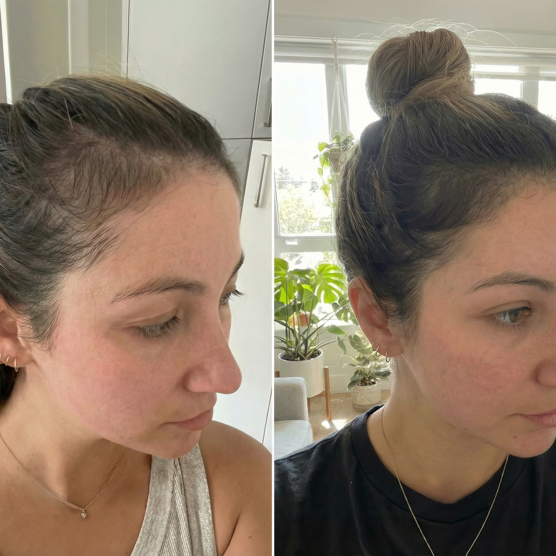 The Root Co. Hair Vitamin