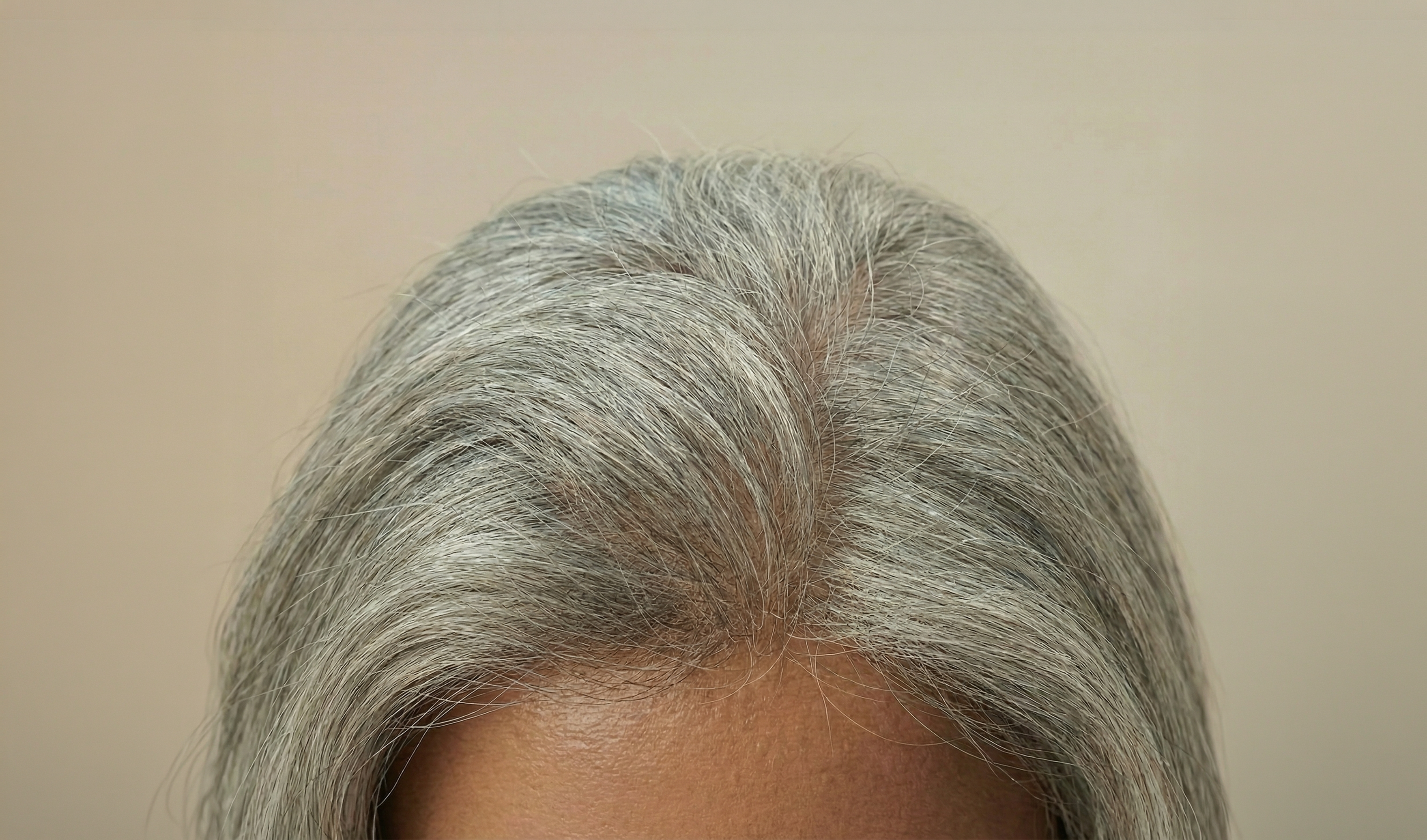 How Much Hair Shedding Is Normal? A Clear Daily Baseline and When to Worry