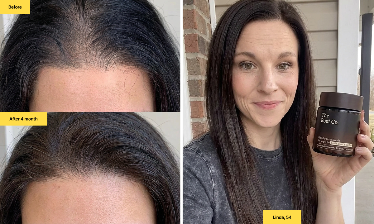 Anagen Phase Explained: What the Hair Growth Phase Does and Why It Matters