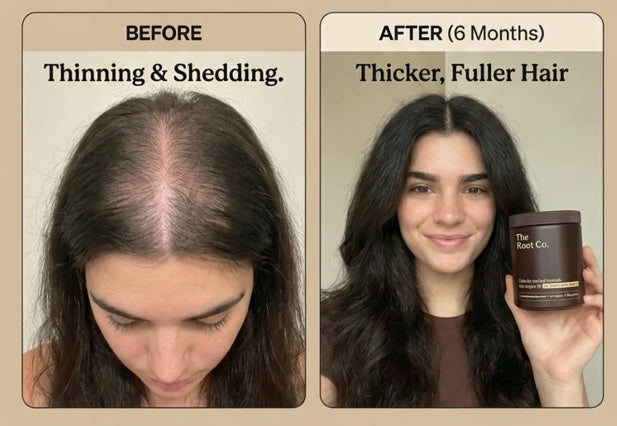 natural hair growth supplements