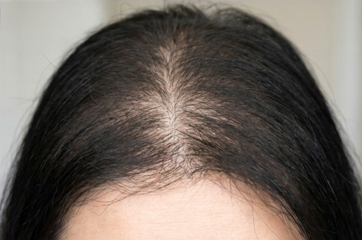 Less shedding