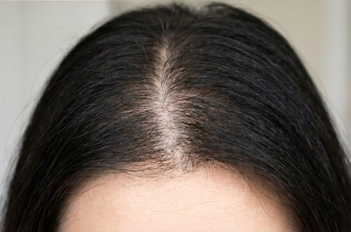 First regrowth&nbsp;