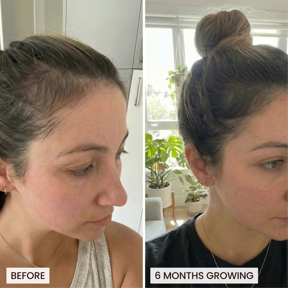 The Root Co. Hair Vitamin